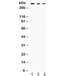 TLN2 / Talin 2 Antibody