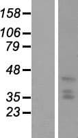 HPH2 / PHC2 Protein (Over-Expression Lysate Myc-DDK (Flag))