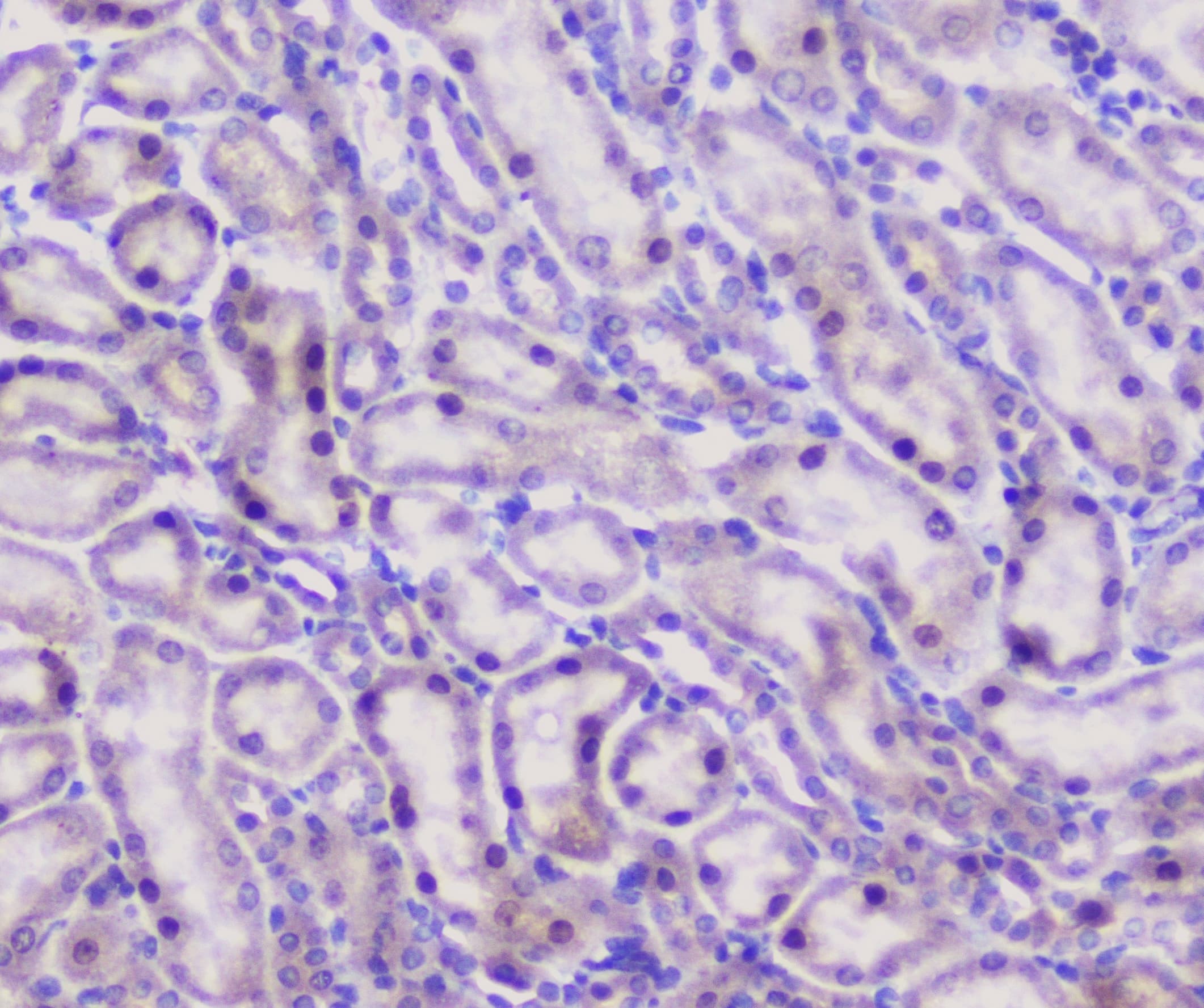 Properdin / CFP Antibody