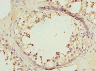 Polyclonal Rabbit anti-Human TC21 / RRAS2 Antibody (IHC, WB)