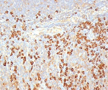 Plasma Cell Antibody (clone LIV3G11)