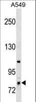 RNF6 Antibody (aa529-558)