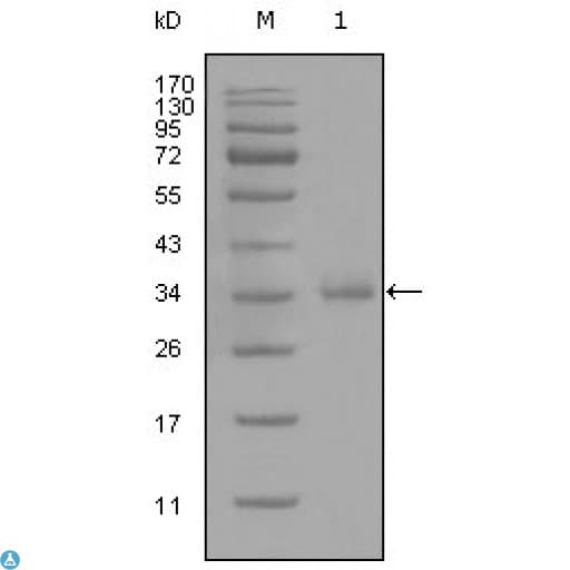CD45 / LCA Antibody