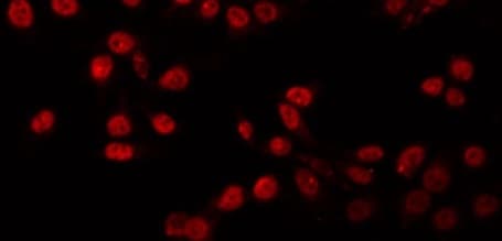 PIAS1 Antibody