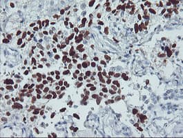 TP53 / p53 Antibody (clone OTI5E2)