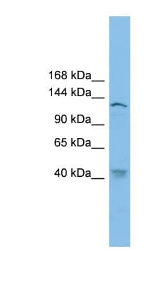 SMC3 / HCAP Antibody (aa215-264)