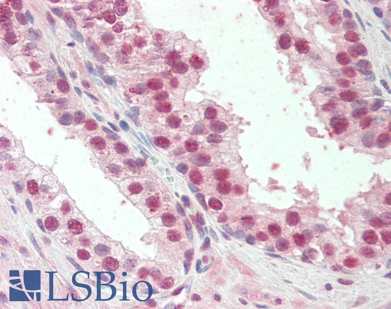IHC-plus™ Polyclonal Goat anti-Human HOXD13 Antibody (aa256-269, IHC)
