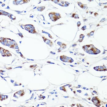 Polyclonal Rabbit anti-Human S100A10 Antibody (IHC, WB)