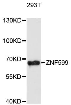 Polyclonal Rabbit anti-Human ZNF599 Antibody (WB)