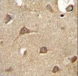 Polyclonal Rabbit anti-Human ENTPD3 Antibody (aa496-527, IHC, WB)