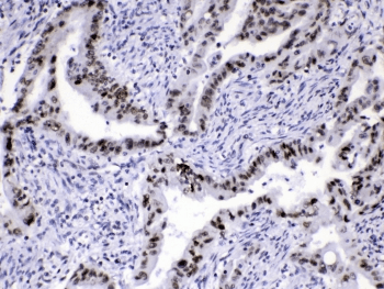 HNRPA1 / HnRNP A1 Antibody