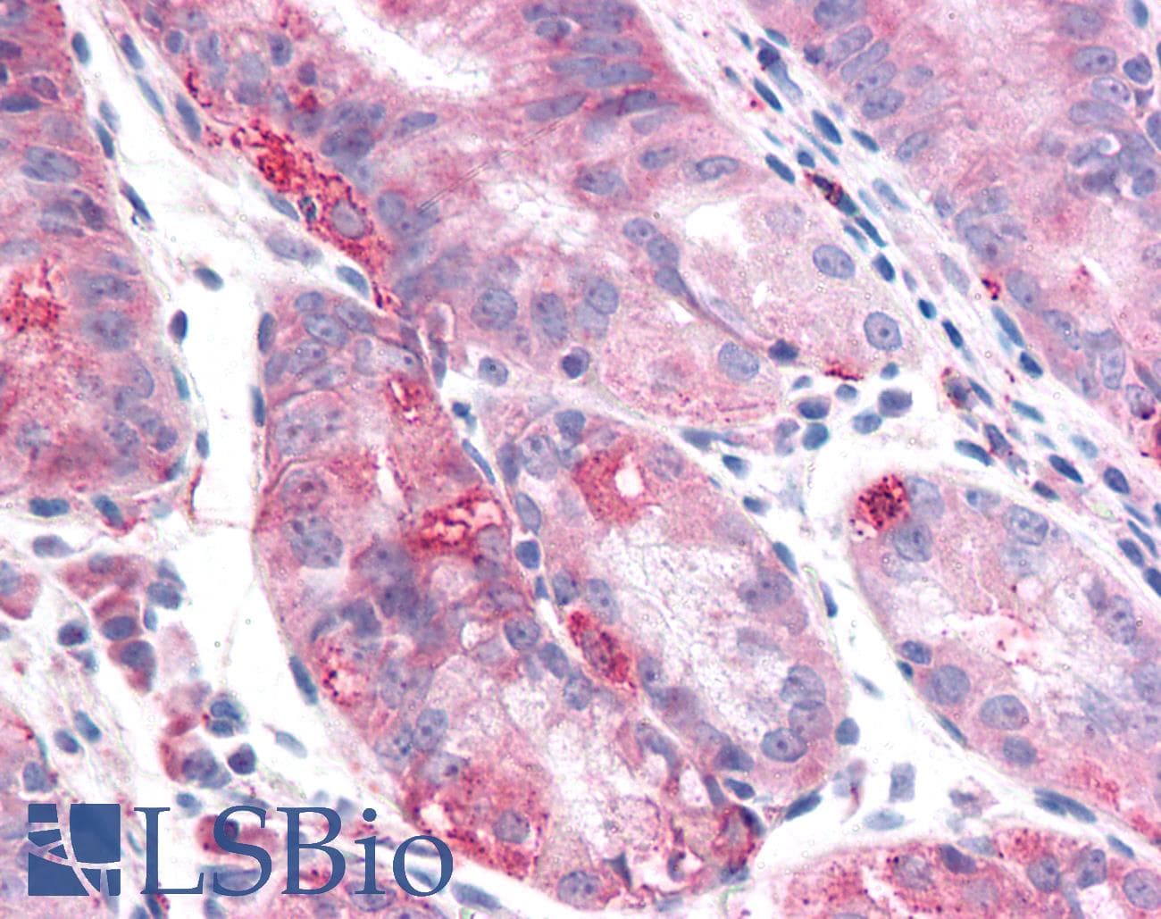 IHC-plus™ Polyclonal Rabbit anti-Human TMEM33 Antibody (Internal, IHC)