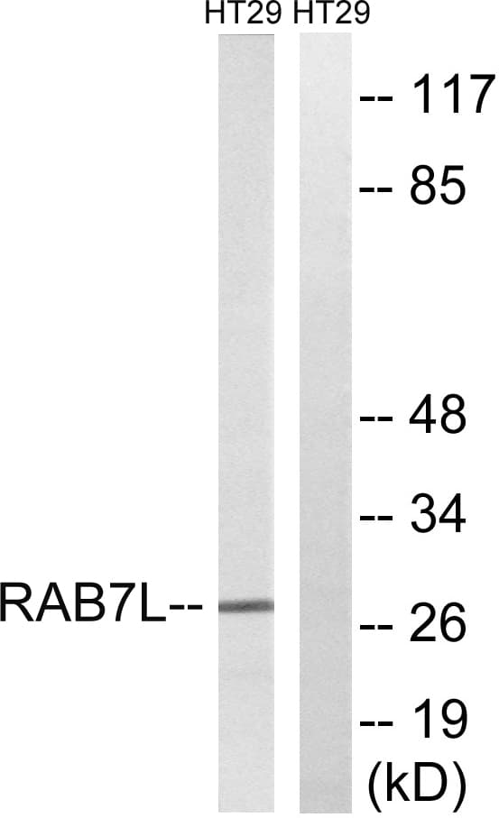 RAB29 / RAB7L1 Antibody (aa115-164)