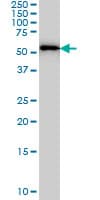 FARSA Antibody (clone 2D8)