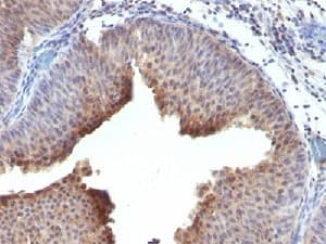 KRT6 / CK6 / Cytokeratin 6 Antibody (C-Terminus, clone LHK6, Azide-free, BSA-free)