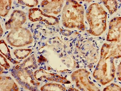 Polyclonal Rabbit anti-Human COA1 Antibody (IHC)