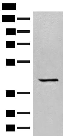 Polyclonal Rabbit anti-Human GPR62 Antibody (IHC, WB)