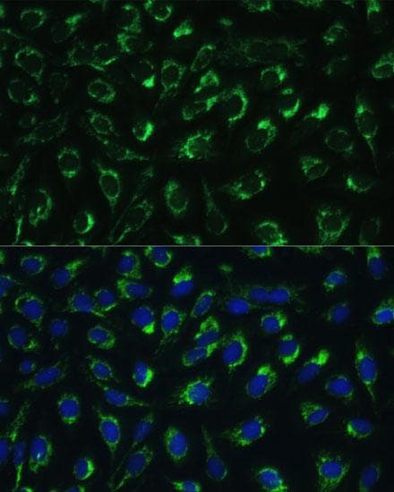 MTIF2 Antibody