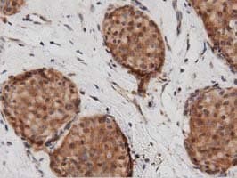 DNAJA2 Antibody (clone OTI1G3)