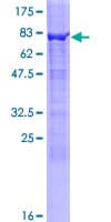 Human TTC5 Protein (Recombinant GST)