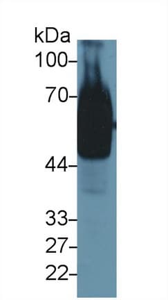 GOLM1 / GP73 / GOLPH2 Antibody (aa133-379, Biotin)