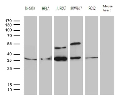 Monoclonal Mouse anti-Human DNAJB6 Antibody (clone OTI3H4, WB)