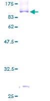 Human SNX9 / WISP Protein (Recombinant GST)