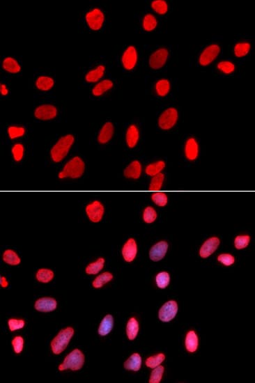 HDGF Antibody