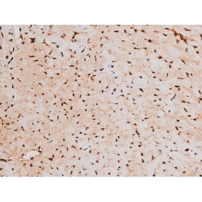 STAT3 Antibody (phospho-Tyr705)