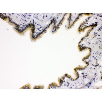 AGER / RAGE Antibody (aa91-120)