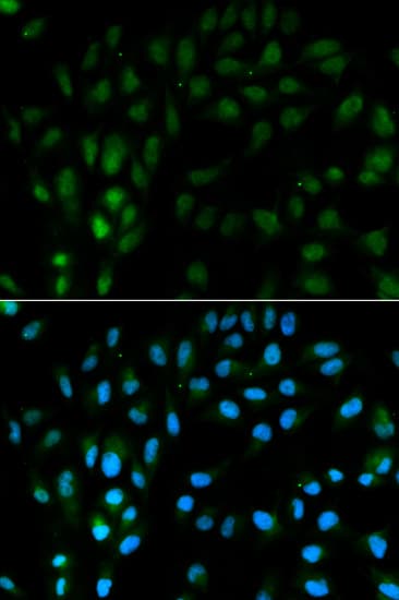 IHC-plus™ TFPI / LACI Antibody