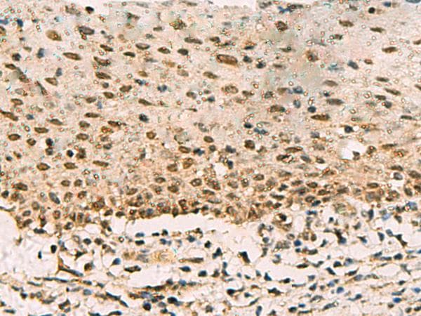 Polyclonal Rabbit anti-Human PHF5A / INI Antibody (IHC)