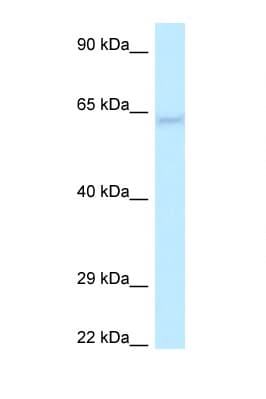 LGI1 Antibody (aa25-74)