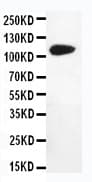 DPYD / DPD Antibody (aa33-52)