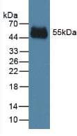 Rabbit Anti-Human IgG2 Secondary Antibody