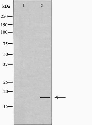 STMN1 / Stathmin / LAG Antibody