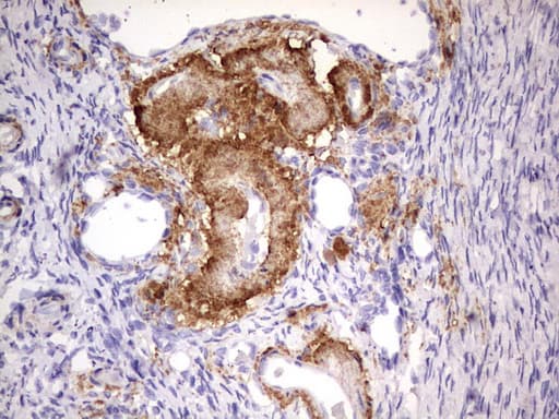 IKZF3 / AIOLOS Antibody (aa1-301, clone OTI4C9, Carrier-free)