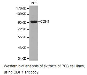 CCT3 Antibody
