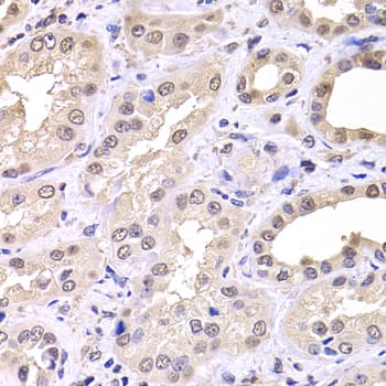 Polyclonal Rabbit anti-Human RTKN / Rhotekin Antibody (IHC, IF, WB)
