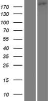 TRPM1 Protein (Over-Expression Lysate Myc-DDK (Flag))