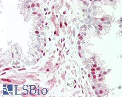 IHC-plus™ MEF2D Antibody (aa475-521)