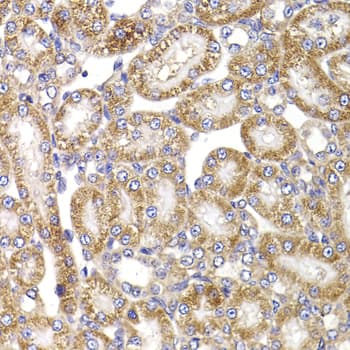 ANAPC5 / APC5 Antibody (AP)