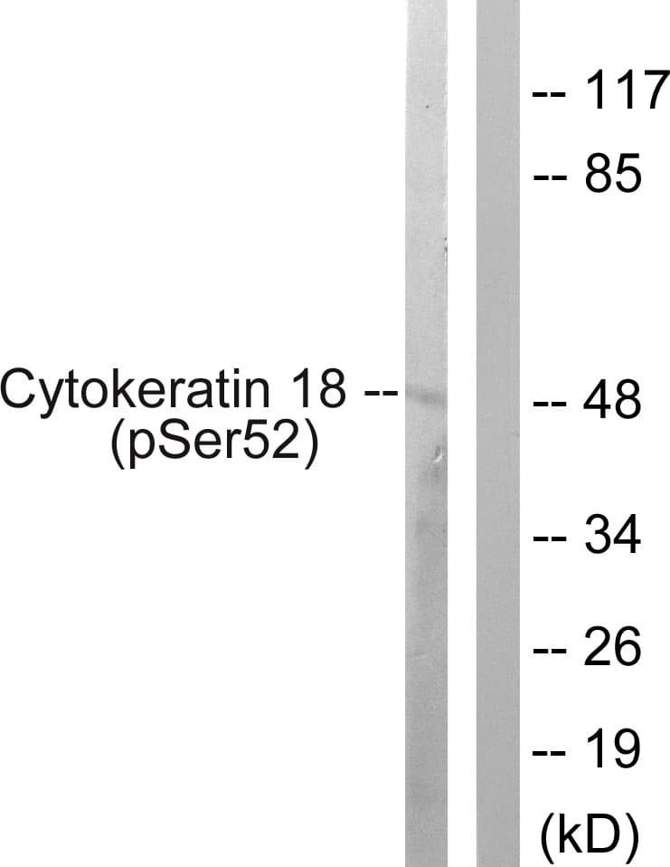KRT18 / CK18 / Cytokeratin 18 Antibody (phospho-Ser52)