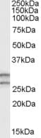 IHC-plus™ Polyclonal Goat anti-Human COMT Antibody (aa52-65, IHC, WB)