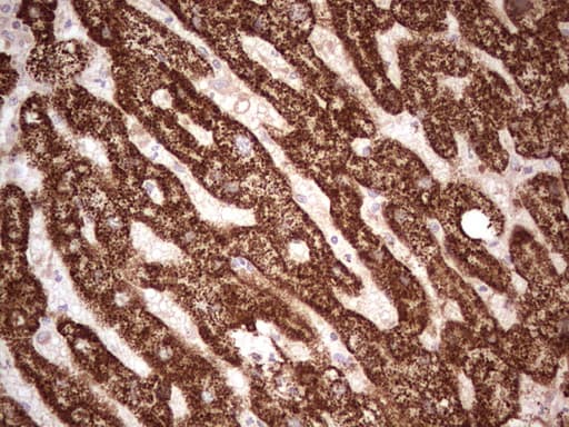 ABAT Antibody (aa29-323, clone OTI7C4)