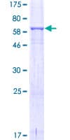 Human DRG1 / NEDD3 Protein (Recombinant GST)