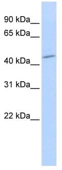 Polyclonal Rabbit anti-Human SGMS1 / TMEM23 Antibody (aa144-193, WB)