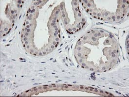 CATIP / C2orf62 Antibody (clone OTI2E6, Carrier-free)