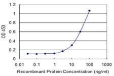 LEPR / Leptin Receptor Antibody (clone 2H5)