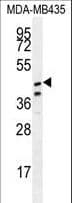 Polyclonal Rabbit anti-Human SAMD7 Antibody (aa202-230, IHC, WB)